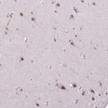 Anti-YLPM1 antibody produced in rabbit Prestige Antibodies&#174; Powered by Atlas Antibodies, affinity isolated antibody, buffered aqueous glycerol solution