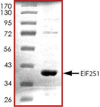 EIF2S1, His tagged human recombinant, expressed in E. coli, &#8805;70% (SDS-PAGE), buffered aqueous glycerol solution