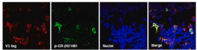 Anti-C9ORF72/C9RANT (Poly-GR) serum, from rabbit