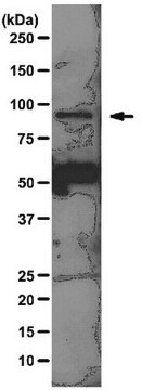 Przeciwciało anty-SUZ12, klon 2AO9 clone 2AO9, from mouse