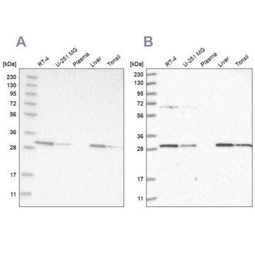 Anti-PROSC antibody produced in rabbit Prestige Antibodies&#174; Powered by Atlas Antibodies, affinity isolated antibody, buffered aqueous glycerol solution, Ab1