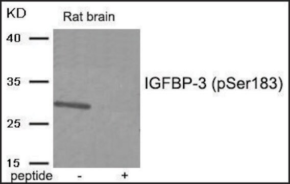 Anti-phospho-IGFBP-3 (pSer183) antibody produced in rabbit affinity isolated antibody