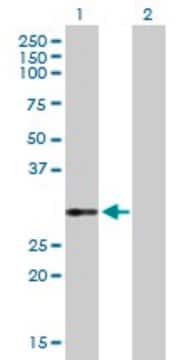 Anti-VWF antibody produced in rabbit purified immunoglobulin, buffered aqueous solution