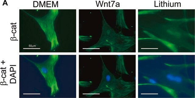 Anti-&#946;-Catenin Antibody, clone 5H10 clone 5H10, Chemicon&#174;, from mouse