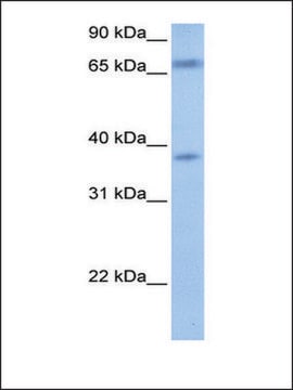 Anti-FEM1B (AB1) antibody produced in rabbit affinity isolated antibody