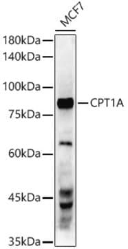 Anti-CPT1A Antibody, clone 3M6E9, Rabbit Monoclonal