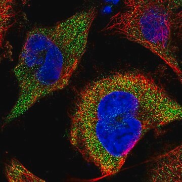 抗CLYBL抗体 ウサギ宿主抗体 affinity isolated antibody, buffered aqueous glycerol solution