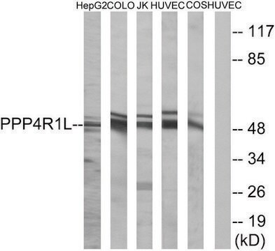 Anti-PPP4R1L antibody produced in rabbit affinity isolated antibody