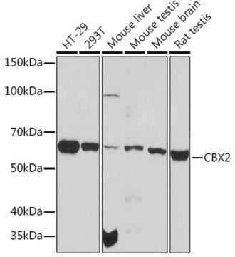 Anti-CBX2 Antibody, clone 3Z6W6, Rabbit Monoclonal