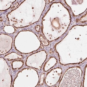 Anti-ARHGAP6 antibody produced in rabbit Prestige Antibodies&#174; Powered by Atlas Antibodies, affinity isolated antibody, buffered aqueous glycerol solution