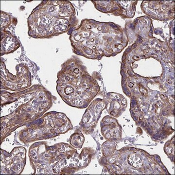 Anti-FAP antibody produced in rabbit Prestige Antibodies&#174; Powered by Atlas Antibodies, affinity isolated antibody, buffered aqueous glycerol solution