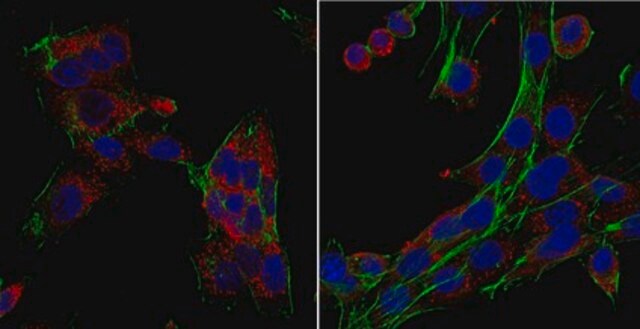 Anti-Laminin Receptor Antibody from rabbit, purified by affinity chromatography