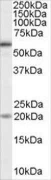 Anti-BMPR1A antibody produced in goat affinity isolated antibody, buffered aqueous solution