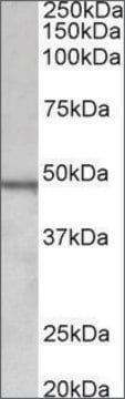 Anti-CHIT1 antibody produced in goat affinity isolated antibody, buffered aqueous solution