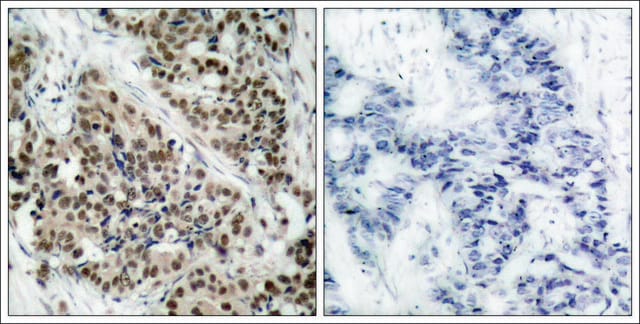 抗-磷酸化-FOXO1 (pSer256) 兔抗 affinity isolated antibody