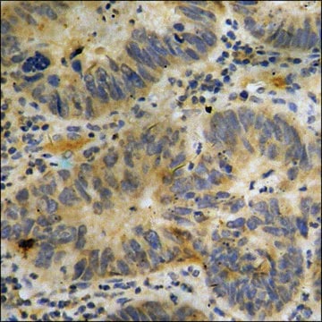 Anti-phospho-p300 (pSer89) antibody produced in rabbit affinity isolated antibody