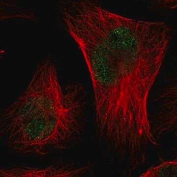 Anti-CMTM3 antibody produced in rabbit Prestige Antibodies&#174; Powered by Atlas Antibodies, affinity isolated antibody, buffered aqueous glycerol solution