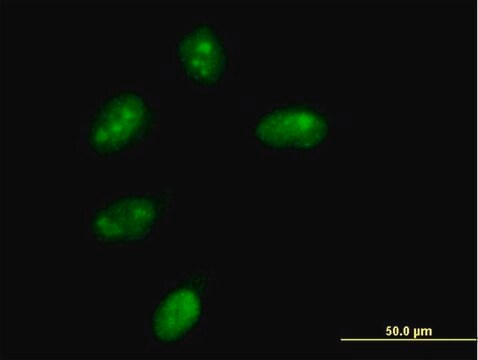 Anti-NMNAT1 antibody produced in mouse purified immunoglobulin, buffered aqueous solution