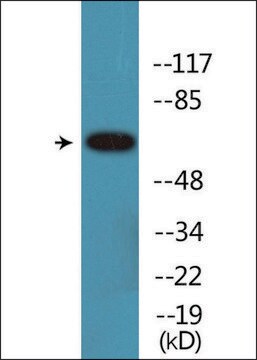 Anti-phospho-Estrogen Receptor-&#945; (pSer104) antibody produced in rabbit affinity isolated antibody