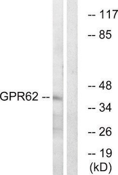 Anti-GPR62 antibody produced in rabbit affinity isolated antibody