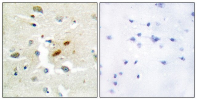 Anti-DNA Polymerase &#950;, N-Terminal antibody produced in rabbit affinity isolated antibody