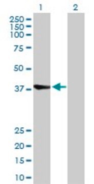 Anti-RBCK1 antibody produced in rabbit purified immunoglobulin, buffered aqueous solution