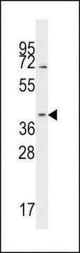 ANTI-HSP40 antibody produced in rabbit IgG fraction of antiserum, buffered aqueous solution