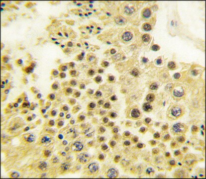 Anti-ZNF219 (C-term) antibody produced in rabbit saturated ammonium sulfate (SAS) precipitated, buffered aqueous solution