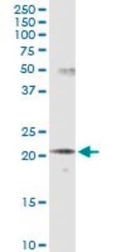 Monoclonal Anti-SCNM1 antibody produced in mouse clone 1E10, purified immunoglobulin, buffered aqueous solution