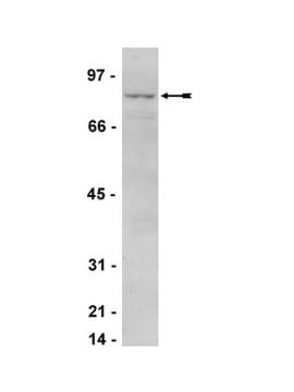 Anti-IKK&#949; Antibody Upstate&#174;, from rabbit