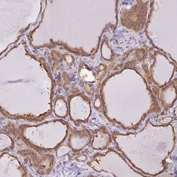 Anti-SNX5 antibody produced in rabbit Prestige Antibodies&#174; Powered by Atlas Antibodies, affinity isolated antibody, buffered aqueous glycerol solution