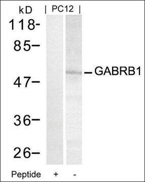 Anti-GABRB1 (Ab-434) antibody produced in rabbit affinity isolated antibody