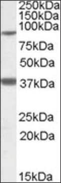 Anti-LASS1 antibody produced in goat affinity isolated antibody, buffered aqueous solution