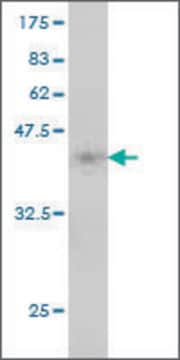 Monoclonal Anti-MTRR antibody produced in mouse clone 1G7, purified immunoglobulin, buffered aqueous solution