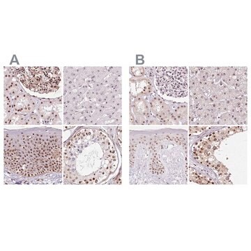 Anti-GNL3 antibody produced in rabbit Prestige Antibodies&#174; Powered by Atlas Antibodies, affinity isolated antibody, buffered aqueous glycerol solution