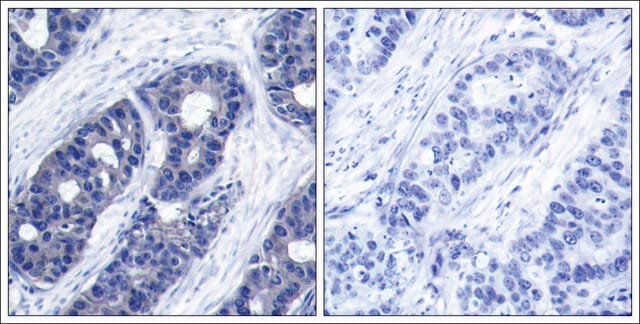 Anti-IRS1 (Ab-636) antibody produced in rabbit affinity isolated antibody