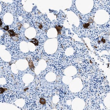 Anti-SLC22A15 antibody produced in rabbit Prestige Antibodies&#174; Powered by Atlas Antibodies, affinity isolated antibody, buffered aqueous glycerol solution