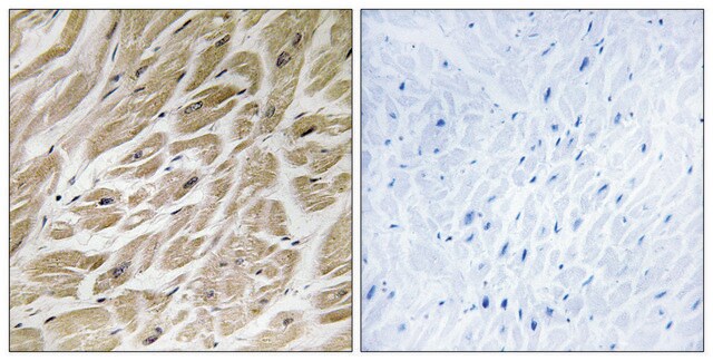 Anti-MRPS24 antibody produced in rabbit affinity isolated antibody