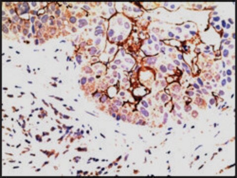 Anti-EPS8 (C-terminal) antibody produced in goat affinity isolated antibody, buffered aqueous solution