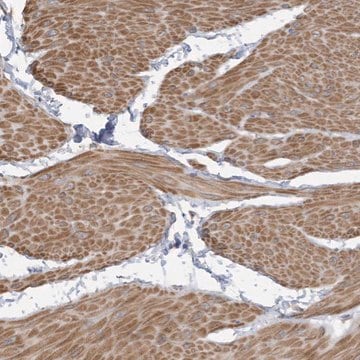 Anti-SLFN14 antibody produced in rabbit Prestige Antibodies&#174; Powered by Atlas Antibodies, affinity isolated antibody, buffered aqueous glycerol solution