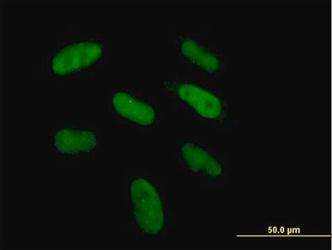 Anti-DGCR6 antibody produced in mouse purified immunoglobulin, buffered aqueous solution