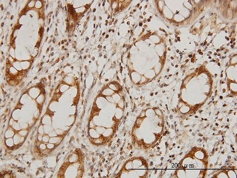 Monoclonal Anti-IKBKAP antibody produced in mouse clone 6G9, purified immunoglobulin, buffered aqueous solution