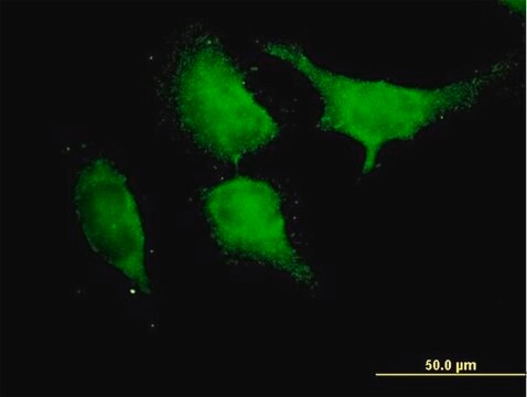 Anti-TRAF6 antibody produced in mouse purified immunoglobulin, buffered aqueous solution