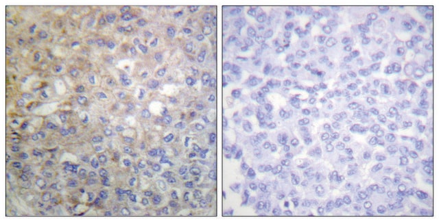 Anti-FGFR1 antibody produced in rabbit affinity isolated antibody