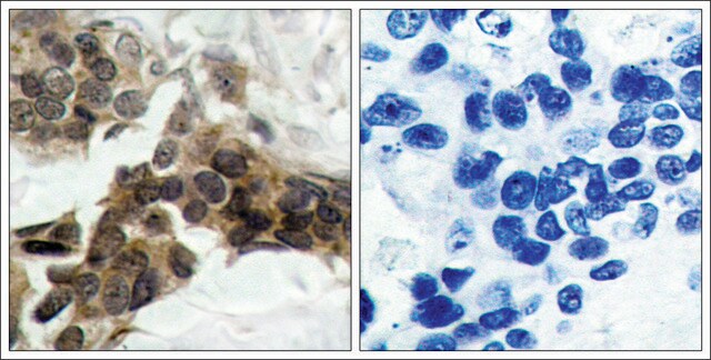 Anti-phospho-NFKBIA (pSer32/pSer36) antibody produced in rabbit affinity isolated antibody