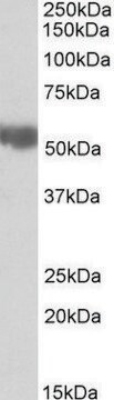 Anti-Aldh3a2 antibody produced in goat affinity isolated antibody, buffered aqueous solution