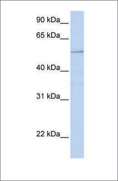 Anti-HNF1B antibody produced in rabbit affinity isolated antibody