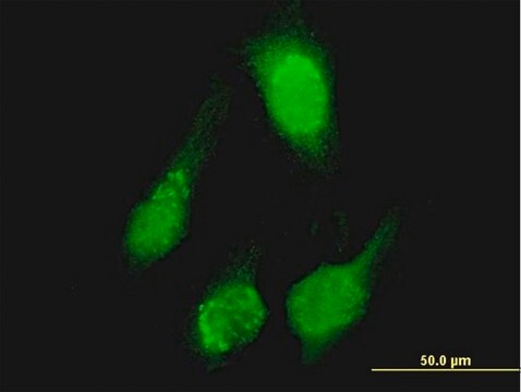 Anti-TCL1A antibody produced in mouse purified immunoglobulin, buffered aqueous solution