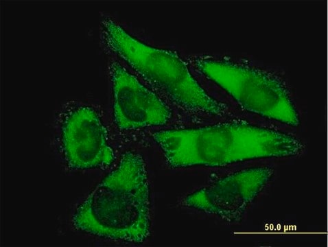 Anti-NACAL antibody produced in mouse purified immunoglobulin, buffered aqueous solution