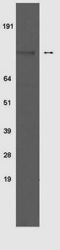 Anti-phospho-Insulinrezeptor(Tyr 1150/1151)-Antikörper, Klon 10C3 clone 10C3, Upstate&#174;, from mouse